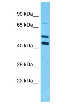 PSMD5 Antibody (aa301-350)