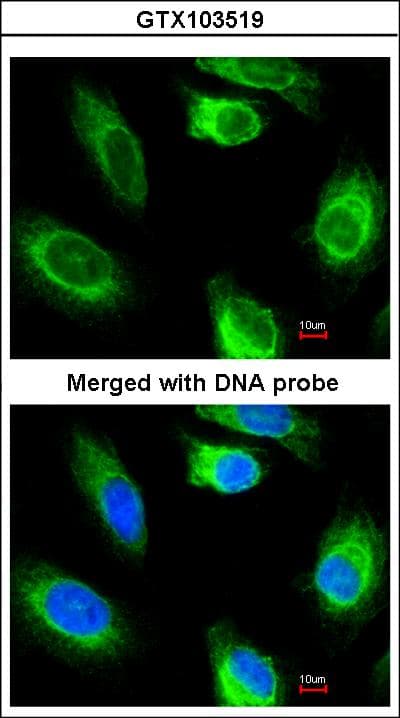 GK2 / Glycerol Kinase 2 Antibody (aa67-338)