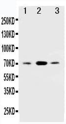 Polyclonal Rabbit anti-Human SDHB Antibody (aa42-59, IHC, WB)