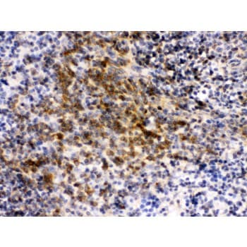 EIF4A2 Antibody (aa5-31)