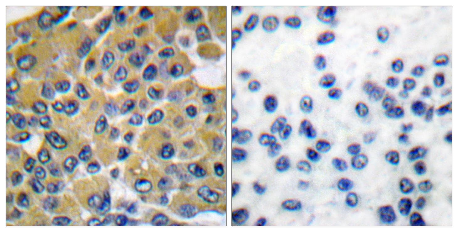PTPN11 / SHP-2 / NS1 Antibody (p542)