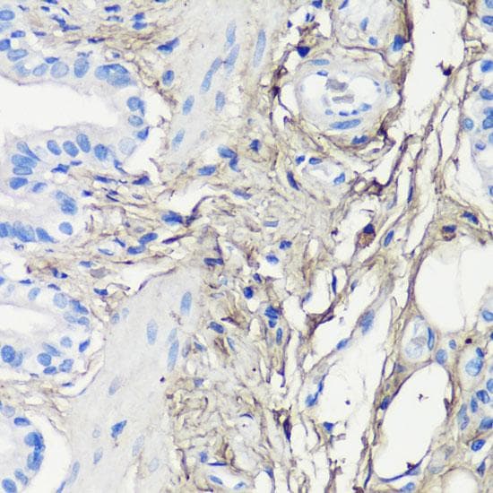 DCN / Decorin Antibody