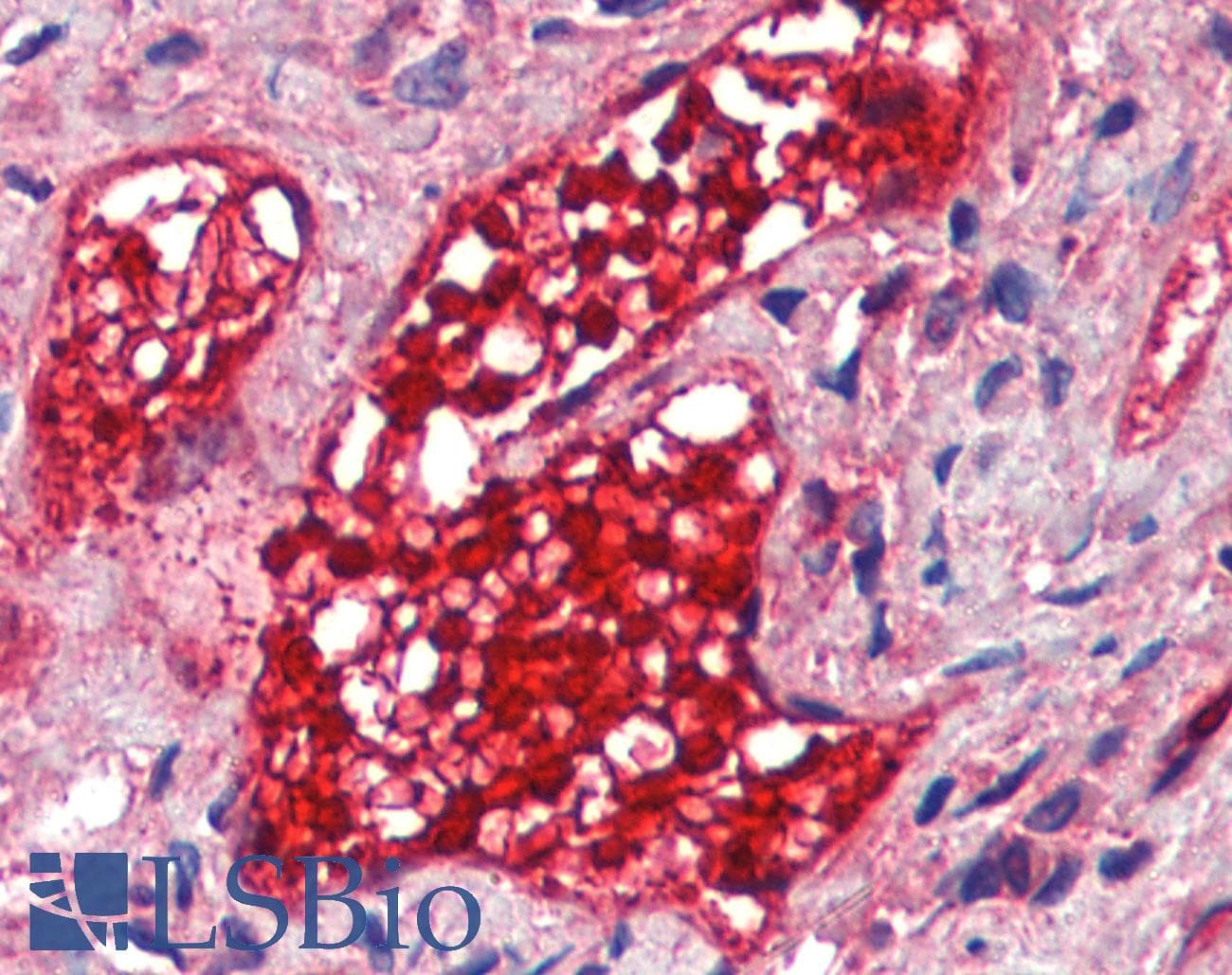 IHC-plus™ Monoclonal Mouse anti-Human CA1 / Carbonic Anhydrase I Antibody (clone 9D6D7, IHC, WB)