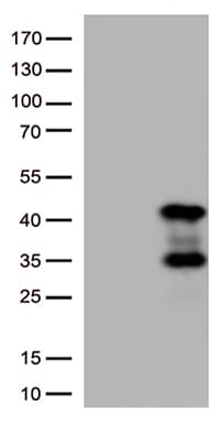 PRKAB1 / AMPK Beta 1 Antibody (aa2-270, clone OTI3D10)