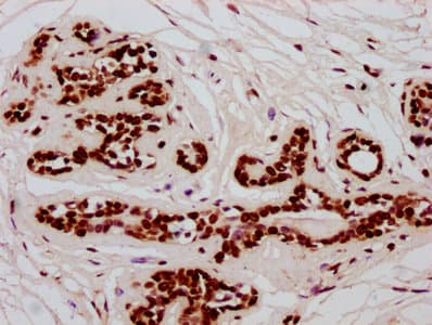 HIST1H2BN Antibody