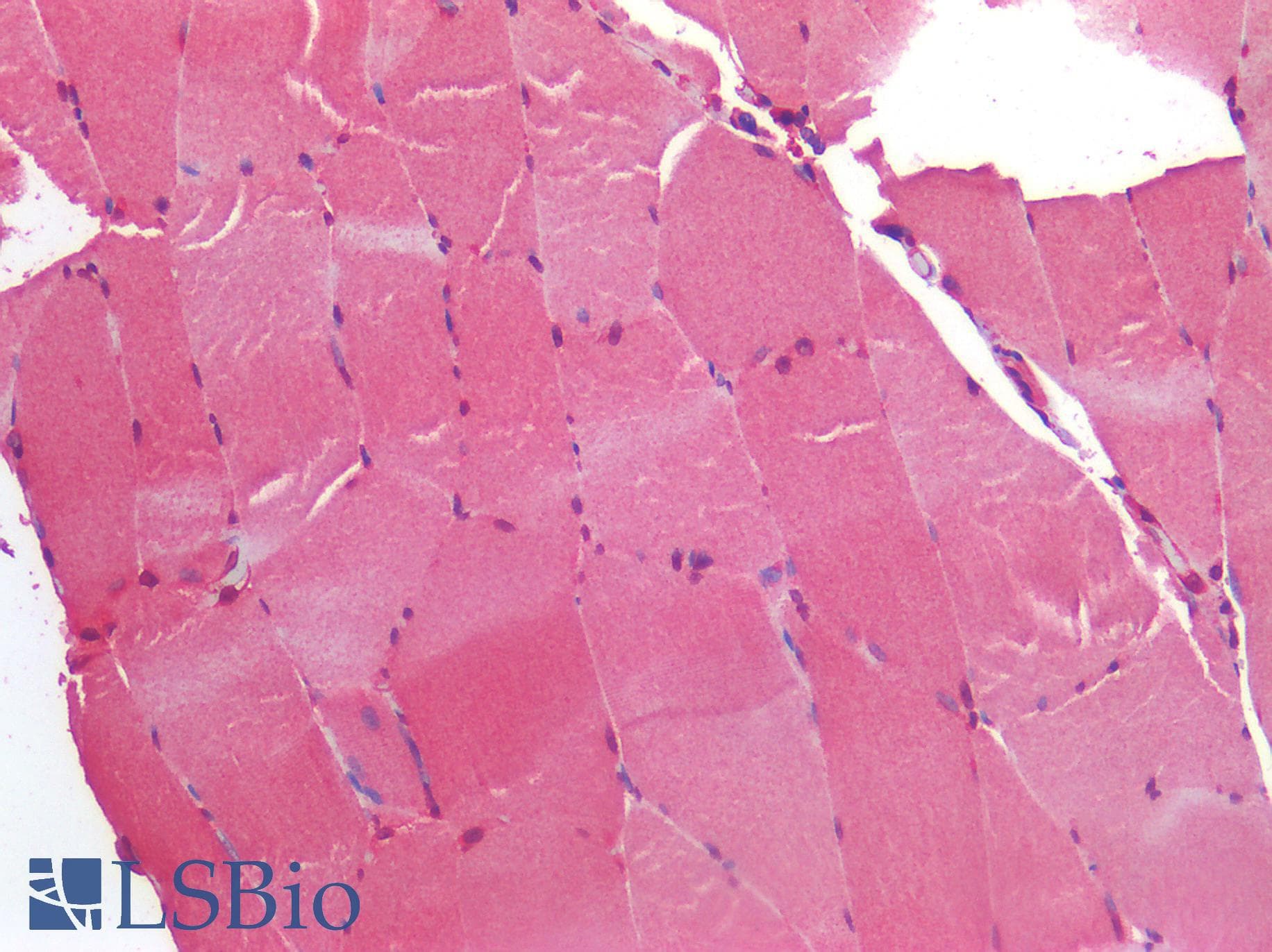 IHC-plus™ Polyclonal Rabbit anti-Human IGF1R / IGF1 Receptor Antibody (IHC)