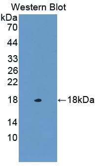 OSTM1 Antibody (PE)