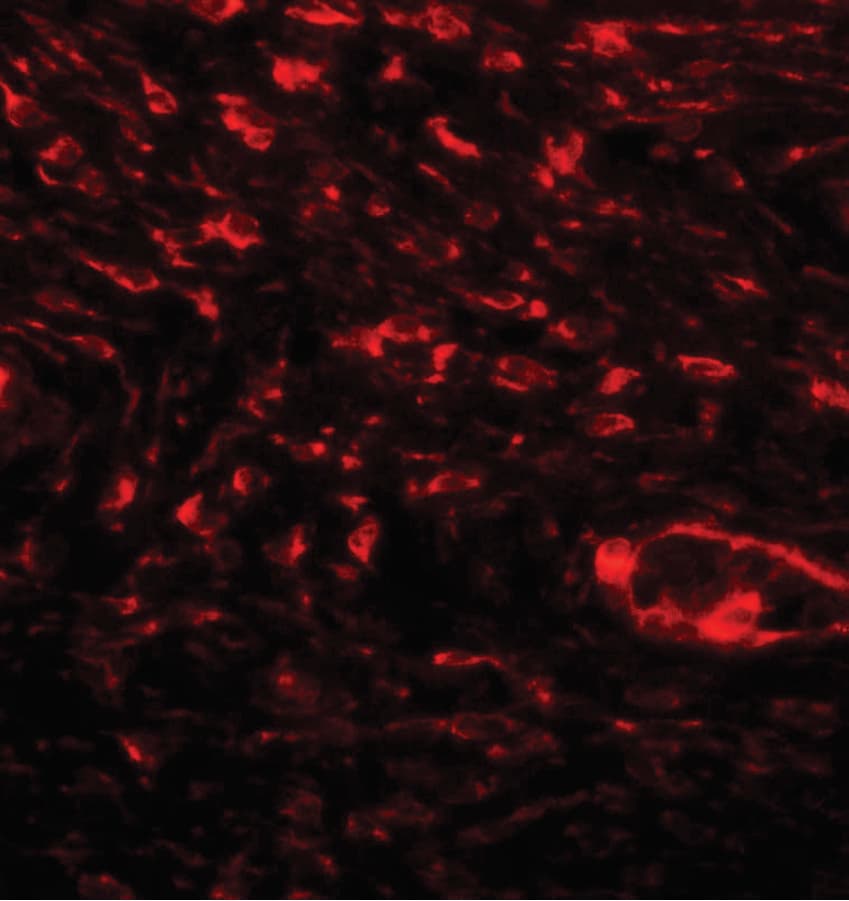 PathPlus™ SPP1 / Osteopontin Antibody