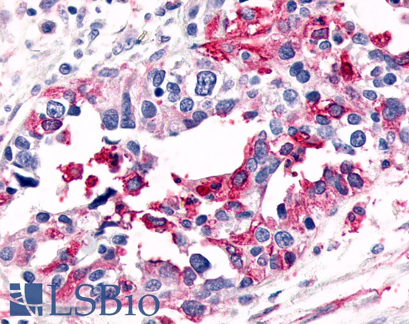 PathPlus™ Polyclonal Rabbit anti-Human ADGRL4 / ELTD1 Antibody (C-Terminus, IHC)
