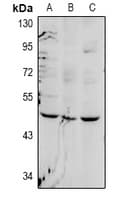 Polyclonal Rabbit anti-Human FOXD4 Antibody (WB)