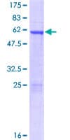 Human HOXD4 Protein (Recombinant GST)