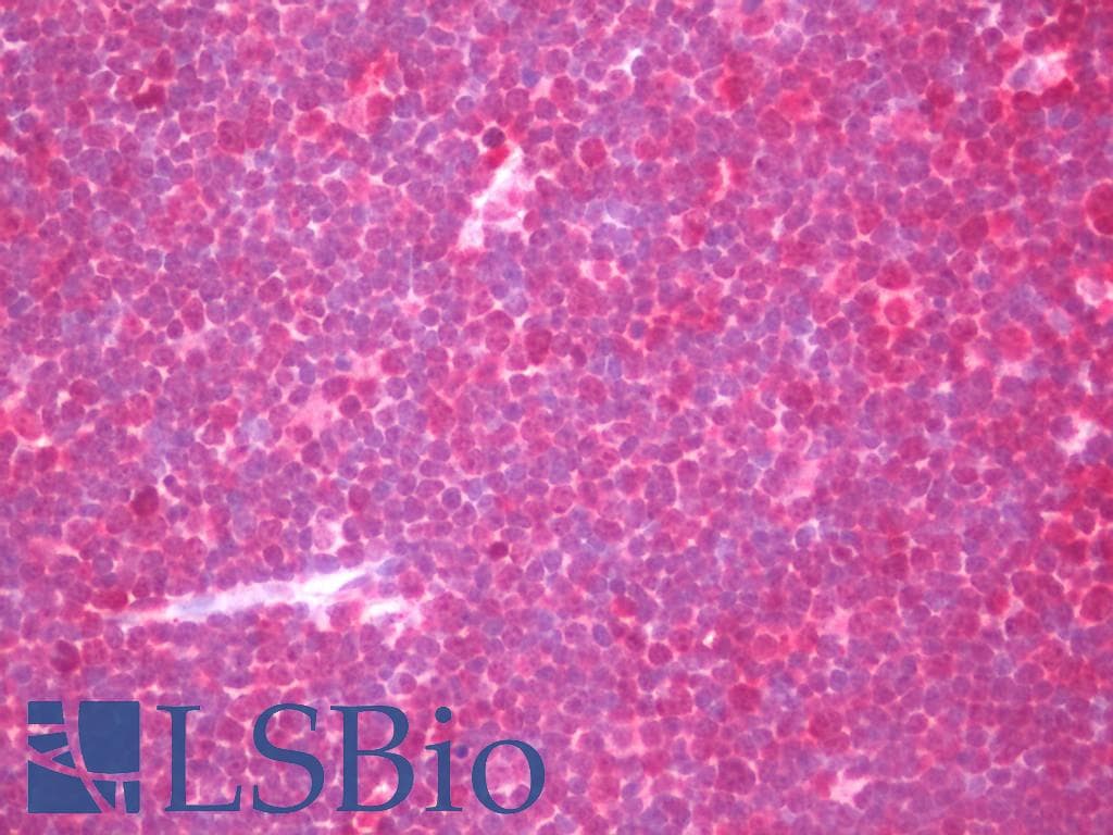 IHC-plus™ INPP5D / SHIP1 / SHIP Antibody (aa1140-1189)