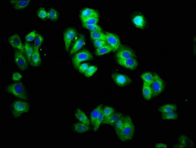 TRH Receptor / TRHR Antibody