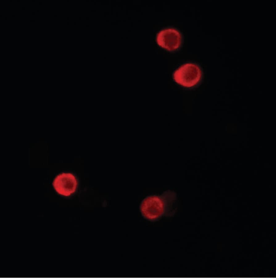 IHC-plus™ FHIT Antibody