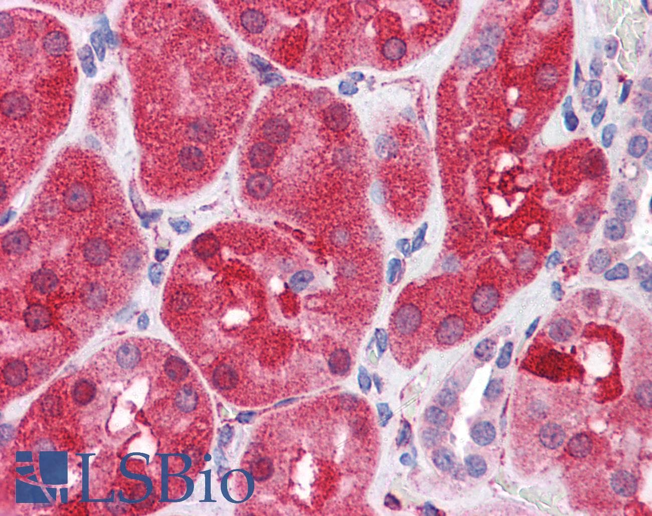 IHC-plus™ Polyclonal Goat anti-Human PTPN11 / SHP-2 / NS1 Antibody (aa584-597, IHC, IF, WB)
