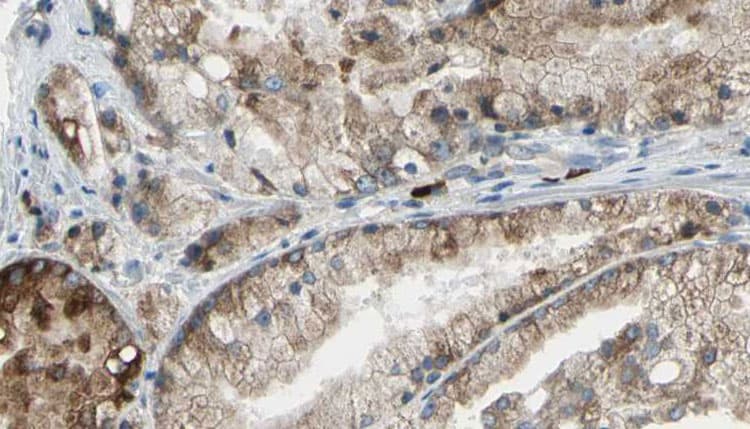 SLC34A2 / NaPi-2b Antibody (aa19-45)