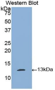 PLAT / TPA Antibody (aa36-126)