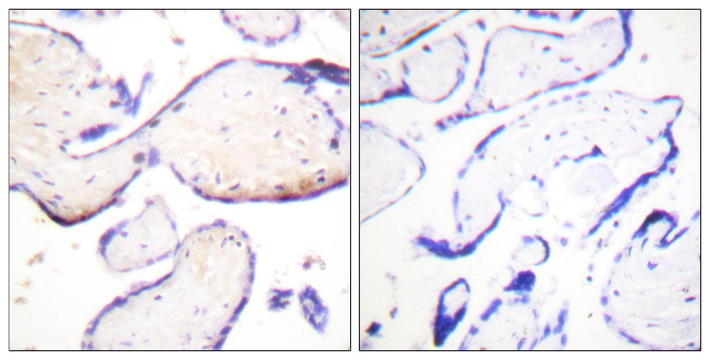 Polyclonal Rabbit anti-Human MSN / Moesin Antibody (phospho-Thr558, IHC, IF, WB)