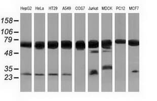 PUS7 Antibody (clone OTI5F12)
