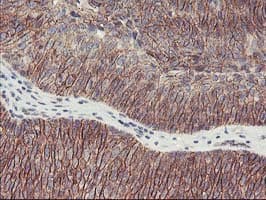 Monoclonal Mouse anti-Human ALOX15 / 15-Lipoxygenase Antibody (clone OTI3G8, IHC, IF, WB)