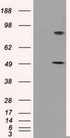 Monoclonal Mouse anti-Human PSMC3 Antibody (clone OTI7B10, IHC, IF, WB)