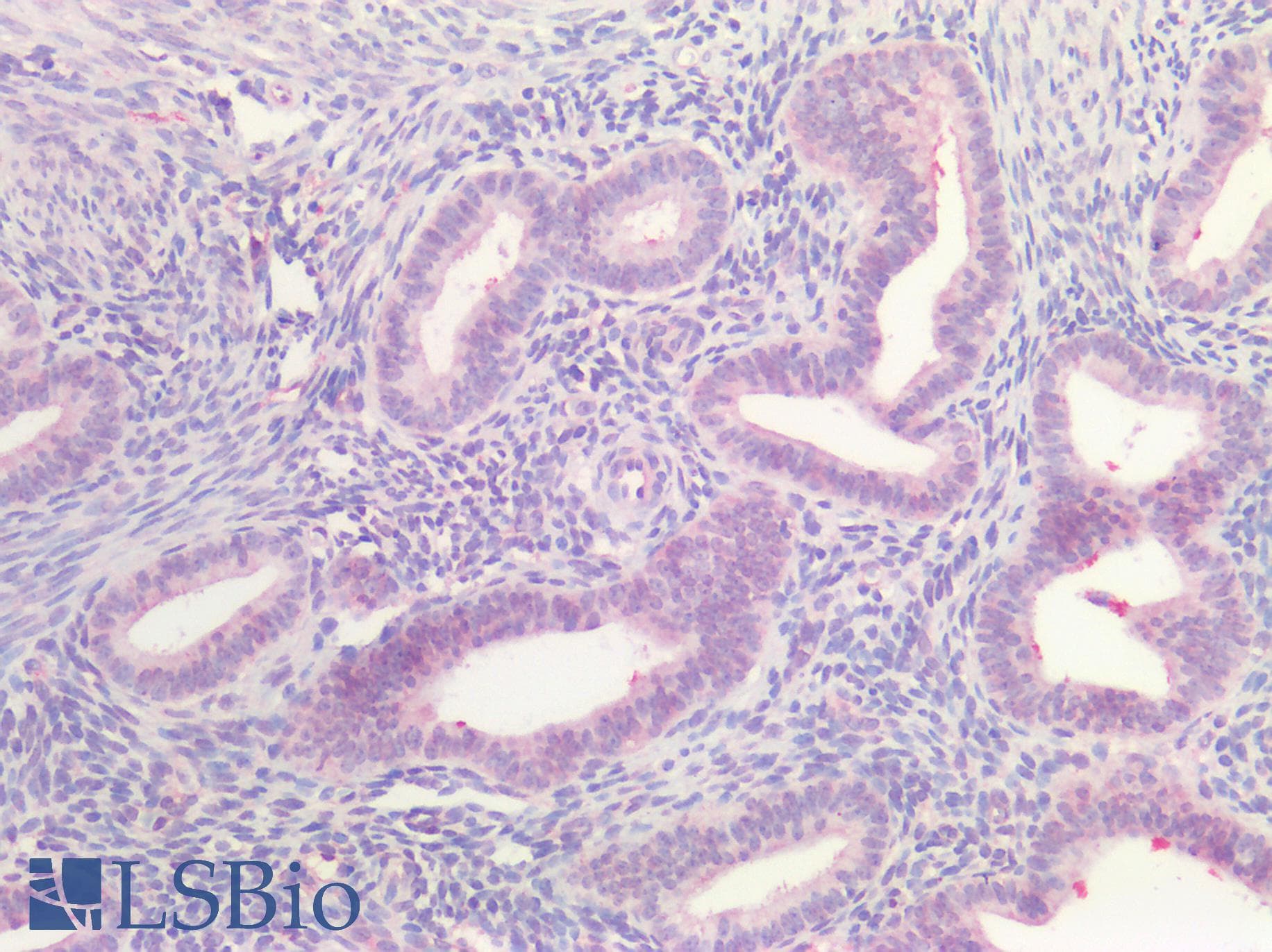 IHC-plus™ Polyclonal Rabbit anti-Human ER Alpha / Estrogen Receptor Antibody (IHC)