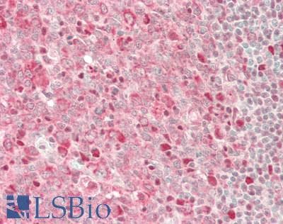 IHC-plus™ Polyclonal Goat anti-Human GAPDH Antibody (aa175-225, IHC, WB)