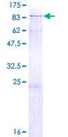 Human DTX1 / Deltex Protein (Recombinant GST)