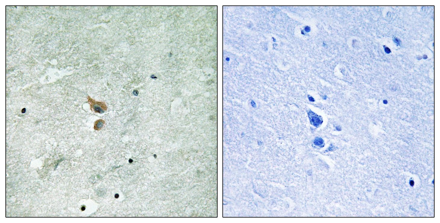 Polyclonal Rabbit anti-Human RICK / RIP2 Antibody (phospho-Ser176, IHC, WB)