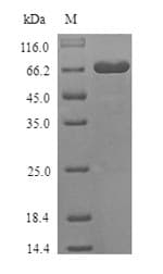 Mouse DSG3 / Desmoglein 3 Protein (Recombinant 6His, N-terminus)