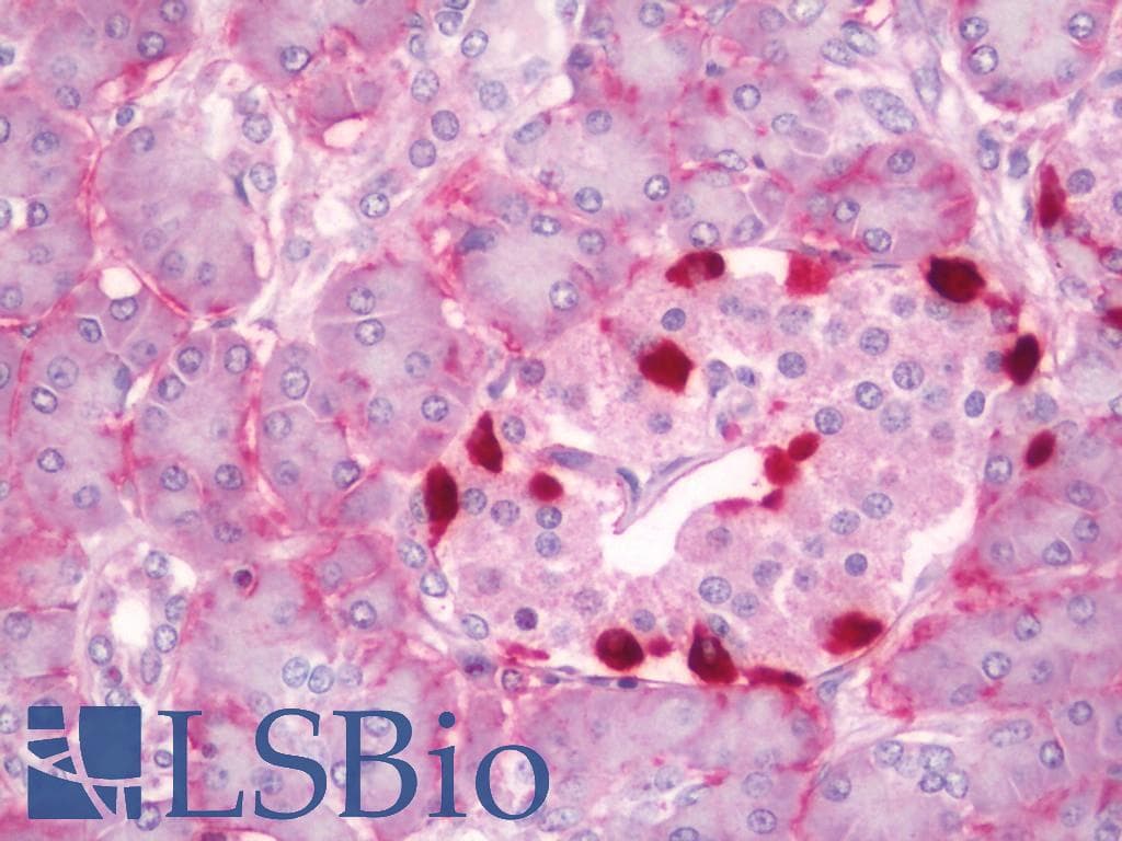 IHC-plus™ NIP3 / BNIP3 Antibody (aa47-96)
