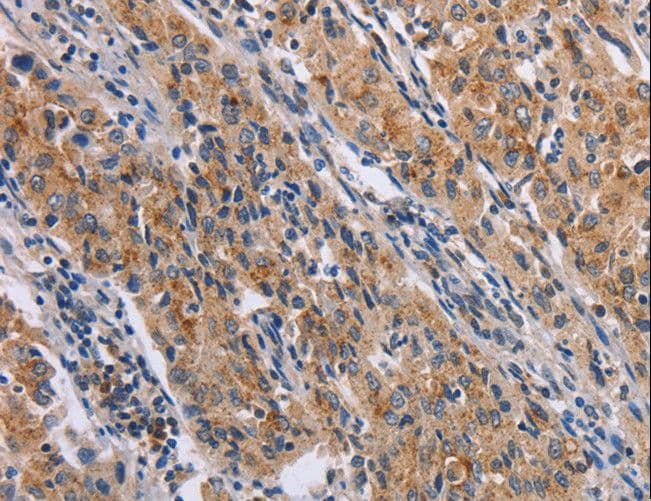 NCR2 / NKP44 Antibody