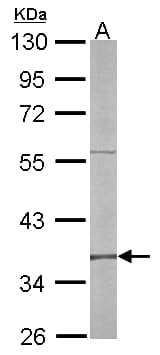 RFC4 Antibody (aa18-323)