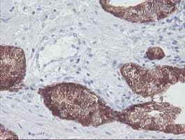 IRF6 Antibody (clone OTI2C10, Carrier-free)