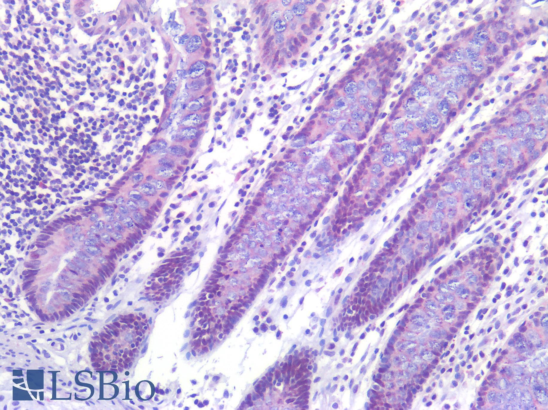 PathPlus™ FOXO1 / FKHR Antibody