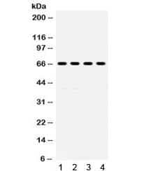 Polyclonal Rabbit anti-Human GRK6 Antibody (WB)