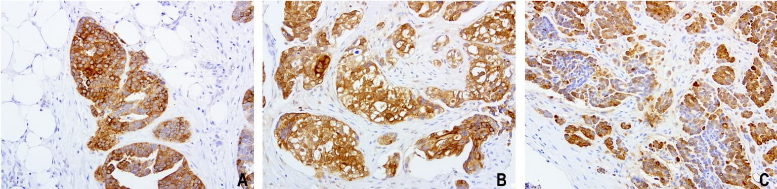 WFDC2 / HE4 Antibody (aa31-124, clone UMAB88)