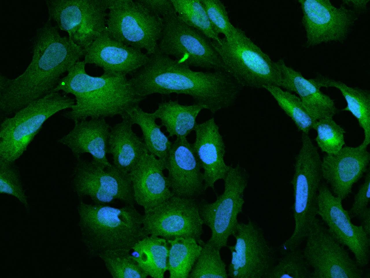 PHGDH Antibody