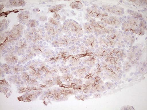 Monoclonal Mouse anti-Human Peripherin Antibody (clone OTI2D5, IHC, WB)