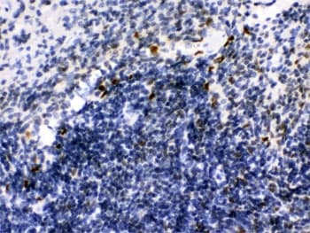 IKZF1 / IKAROS Antibody