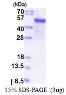 Human EPHX1 / Epoxide Hydrolase 1 Protein (Recombinant)