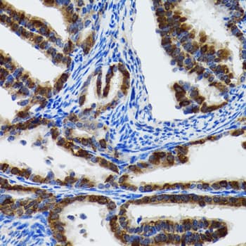 Polyclonal Rabbit anti-Human HSPH1 / HSP105 Antibody (IHC, WB)