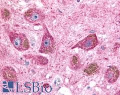 PathPlus™ NTSR2 / NTR2 Antibody (Extracellular Domain)