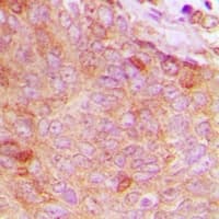 CPNE8 / Copine VIII Antibody (N-Terminus)
