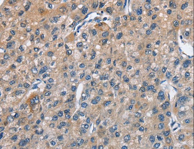TRIP4 / ASC-1 Antibody