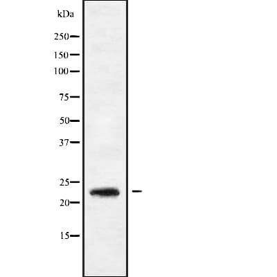 Polyclonal Rabbit anti-Human RAB9B Antibody (WB)