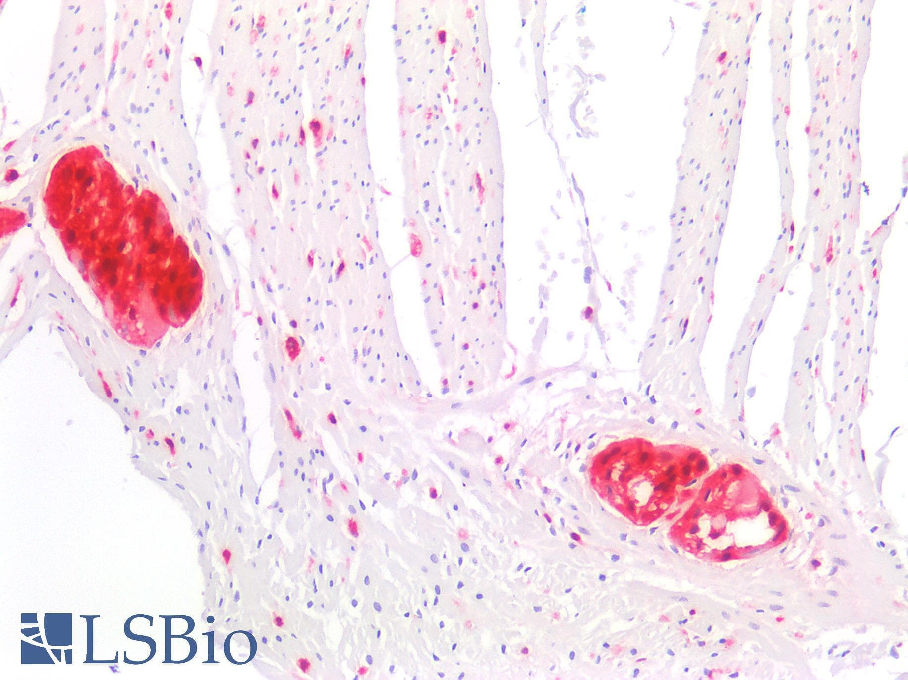 PathPlus™ Monoclonal Mouse anti-Bovine S100 Protein Antibody (clone 4C4.9, IHC)