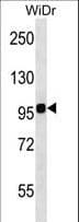 ITGB7 / Integrin Beta 7 Antibody (aa737-765)