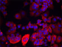 PathPlus™ Monoclonal Mouse anti-Human KRT19 / CK19 / Cytokeratin 19 Antibody (clone A53-B/A2, IHC, WB)