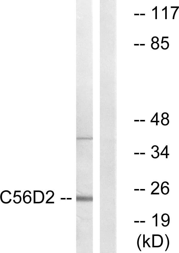 CYB561D2 Antibody (aa55-104)